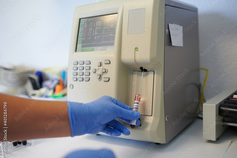 Crop anonymous medical technologist in sterile gloves with blood tube near hematology analyzer while making diagnostic in lab
