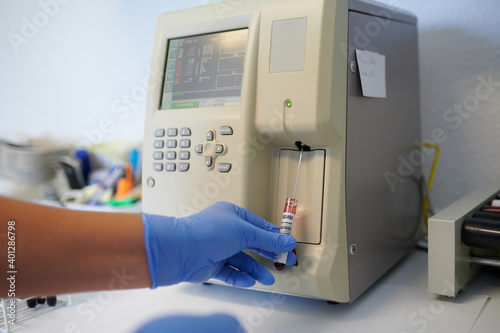 Crop anonymous medical technologist in sterile gloves with blood tube near hematology analyzer while making diagnostic in lab photo