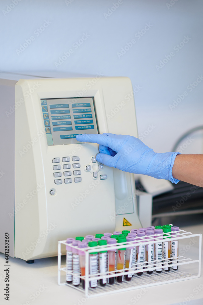 Crop unrecognizable medical technologist touching display of hematology analyzer near table with blood tubes in lab Crop unrecognizable medical technologist touching display of hematology analyzer near table with blood tubes in lab