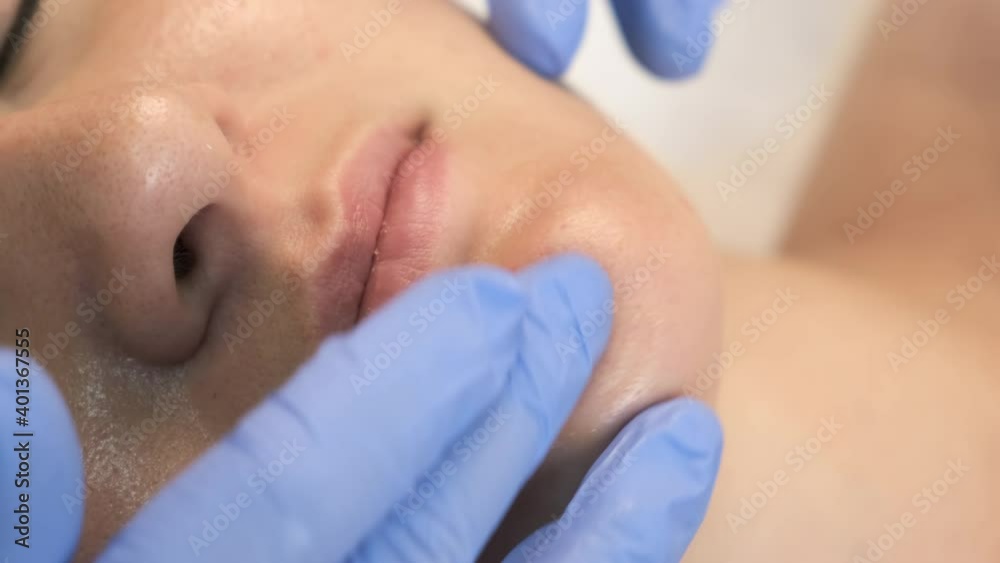 Beautician is making cure procedure on patient's face. Cosmetologist is applying yellow peeling on woman's face massaging movements in beauty clinic, chin closeup. Drops of medicine on woman's chin.