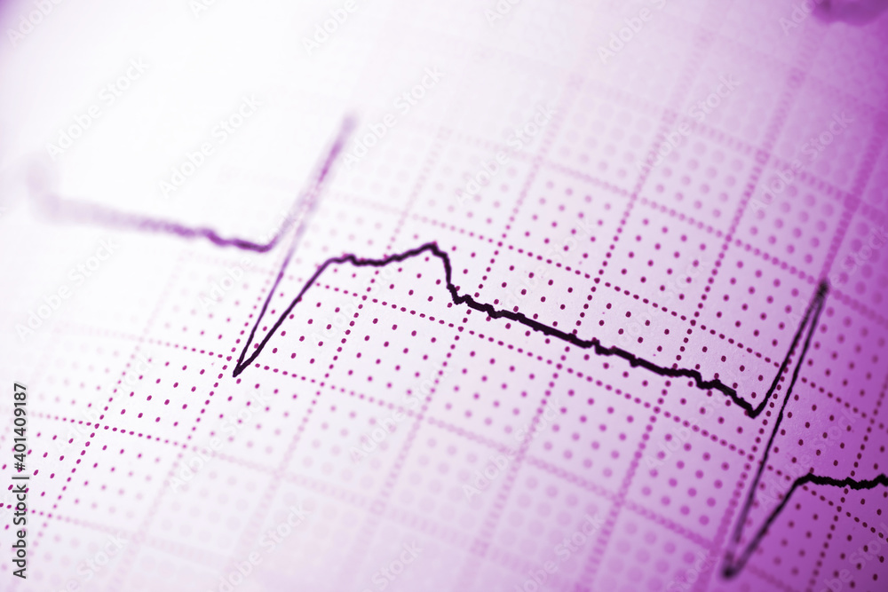 Electrocardiograph closeup view Electrocardiograph closeup view