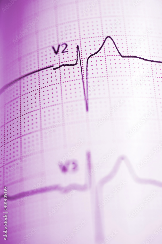 Electrocardiograph closeup view