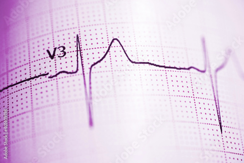 Electrocardiograph closeup view