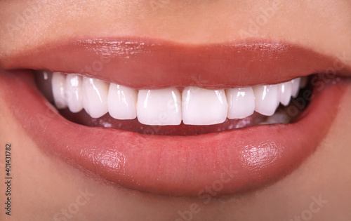 Perfect Close Up Sensual sexy Seductive Plump Lips woman smile . White beautiful Teeth bleaching ceramic crowns whitening young lady smiling. Dental zircon implants restoration surgery Fashion concept