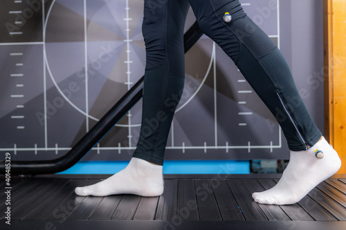 Walking Gait Analysis on Treadmill photo