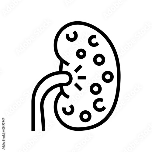 nephritis kidney line icon vector. nephritis kidney sign. isolated contour symbol black illustration
