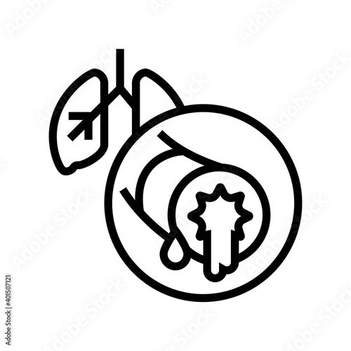 bronchiectasis respiratory disease line icon vector. bronchiectasis respiratory disease sign. isolated contour symbol black illustration