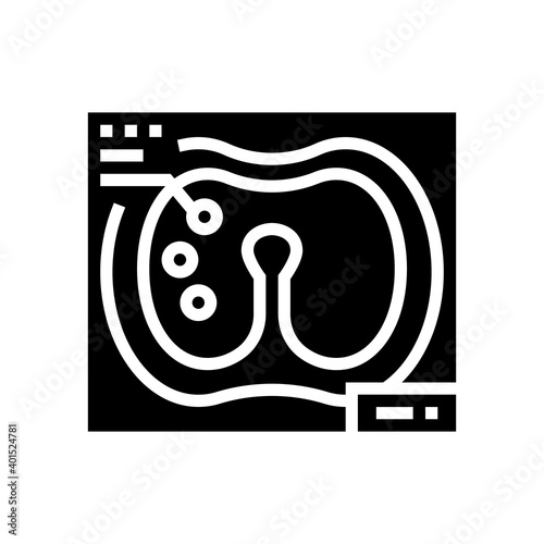 larynx x-ray glyph icon vector. larynx x-ray sign. isolated contour symbol black illustration