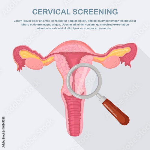 Cervical screening, examination for cancer. Uterus with ovary, cervix, fallopian tubes, magnifier