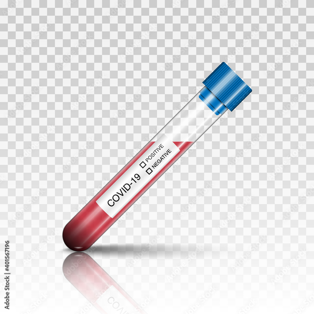 Coronavirus covid 19 infected blood sample in test tube, vector illustration Coronavirus covid 19 infected blood sample in test tube, vector illustration