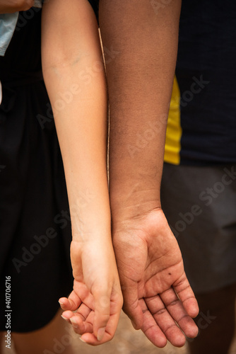 Arms of different colors, black and white 