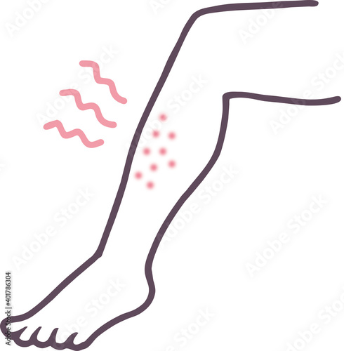 足のぶつぶつがひりひり痛むイラスト素材