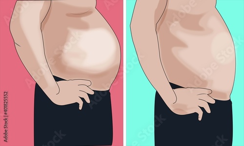 weight

loss
man
belly
body
before
after
abdomen
slimming
slim
fat
overweight
problem
vector
illustration
obesity
muscle
diet
