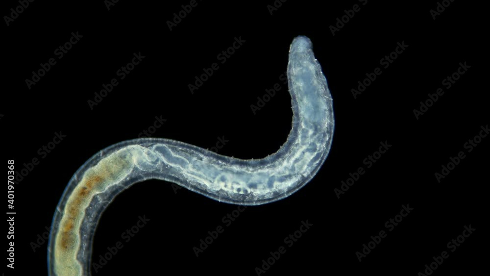 the worm Enchytraeus sp. under the microscope, Oligochaeta, order Haplotaxida. Lives both in soil and water. Diluted as food for aquarium fish the worm Enchytraeus sp. under the microscope, Oligochaeta, order Haplotaxida. Lives both in soil and water. Diluted as food for aquarium fish