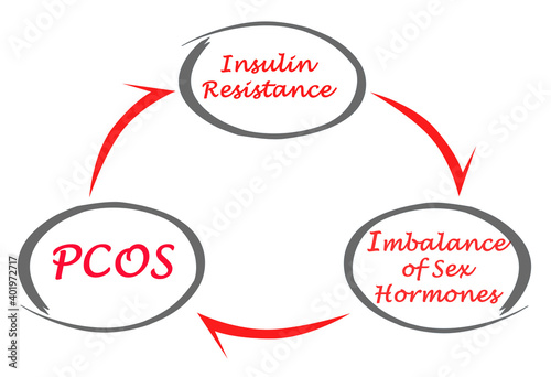 Cycle leding to PCOS photo