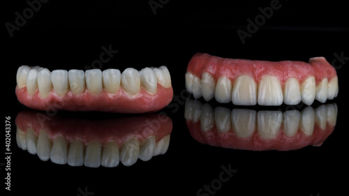metal ceramic dentures with pink gums for the upper and lower jaw, filmed on black glass with reflection