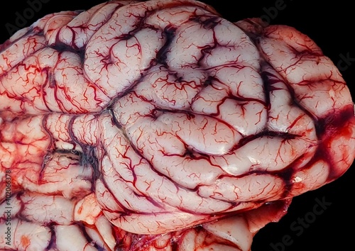 Obraz na plátne a brain with blood veins