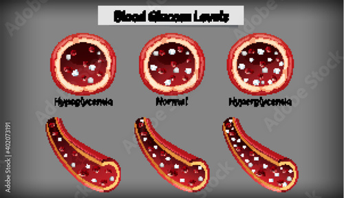 Medical blood glucose level
