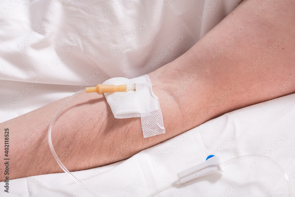 Close up man arm with Intravenous therapy Close up man arm with Intravenous therapy