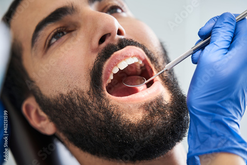 фотографія Multiracial man having his teeth examined by serious female doctor