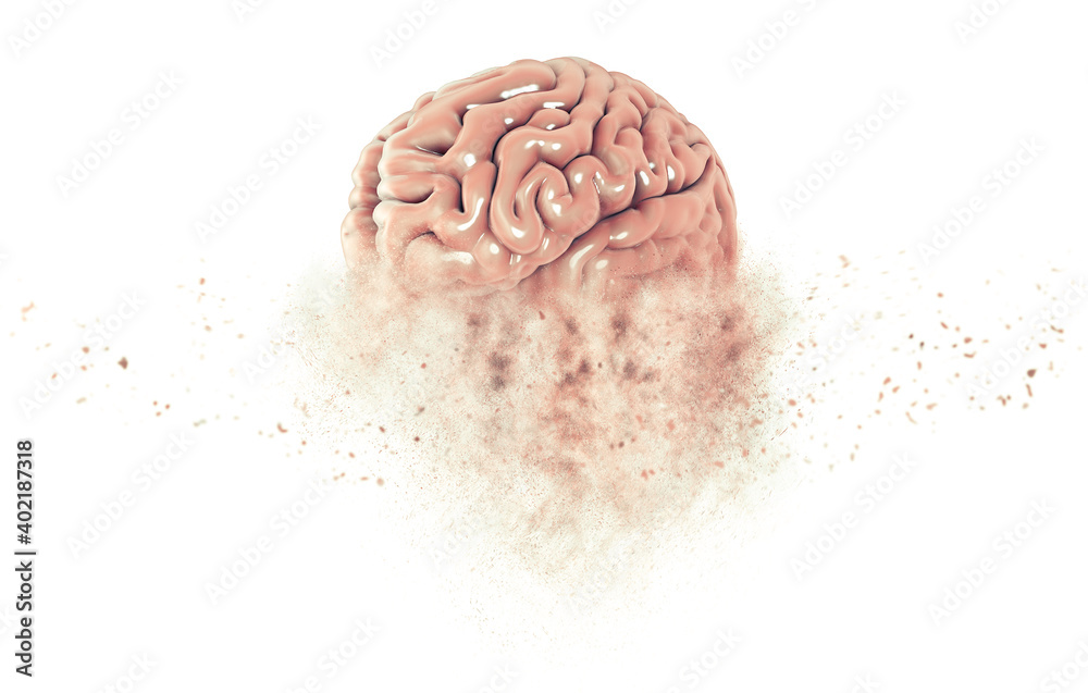 Memory lapses, forgetting things, degenerative disease. Brain problems. Parkinson and alzheimer desease. Mental health. Stroke, synapses and neurnons interaction. 3d render Memory lapses, forgetting things, degenerative disease. Brain problems. Parkinson and alzheimer desease. Mental health. Stroke, synapses and neurnons interaction. 3d render