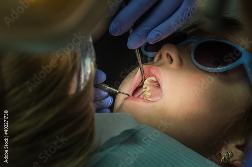 Children's dentist treats baby teeth	