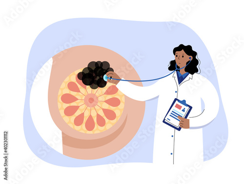 Breast disease concept