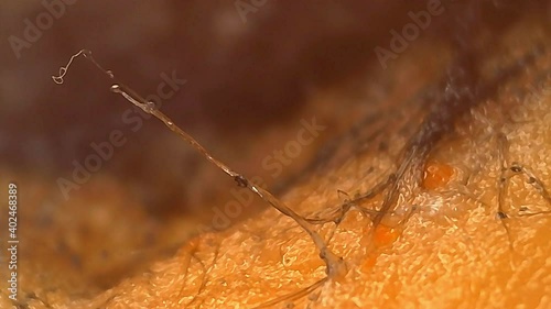 Microscope Mold Sporangiospore Stolon 1000x Biology Fungi photo