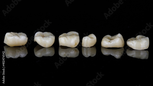 dental crowns made of ceramic for chewing teeth, on black glass with reflection