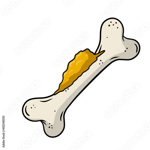 Bone cancer. Disease of the musculoskeletal system. Growth of harmful cells