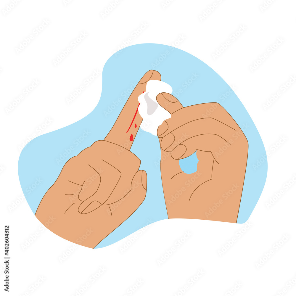Wound treatment with cotton wool, first aid treatment, abrasion