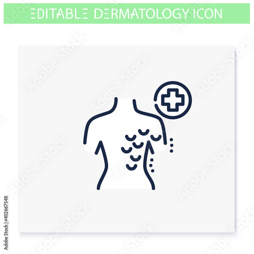Atopic dermatitis line icon. Skin problem, dermatologic disease. Allergy, eczema. Skincare, cosmetology, medicine. Health and beauty concept. Isolated vector illustration. Editable stroke 