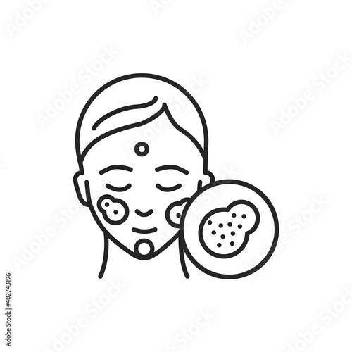 Rosacea disease line color icon. Sign for web page, mobile app