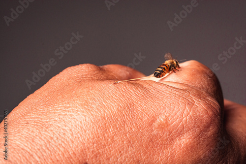 macro de una abeja obrera picando la mano de una persona  photo