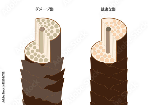 キューティクル