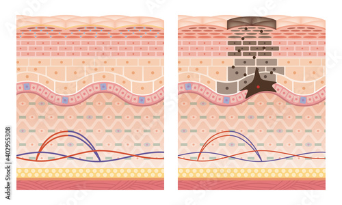 Cross section of the skin 9 front No commentary