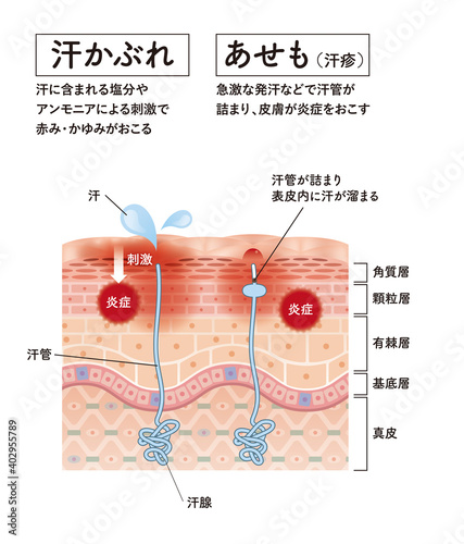 Cross section of the skin 31 front photo