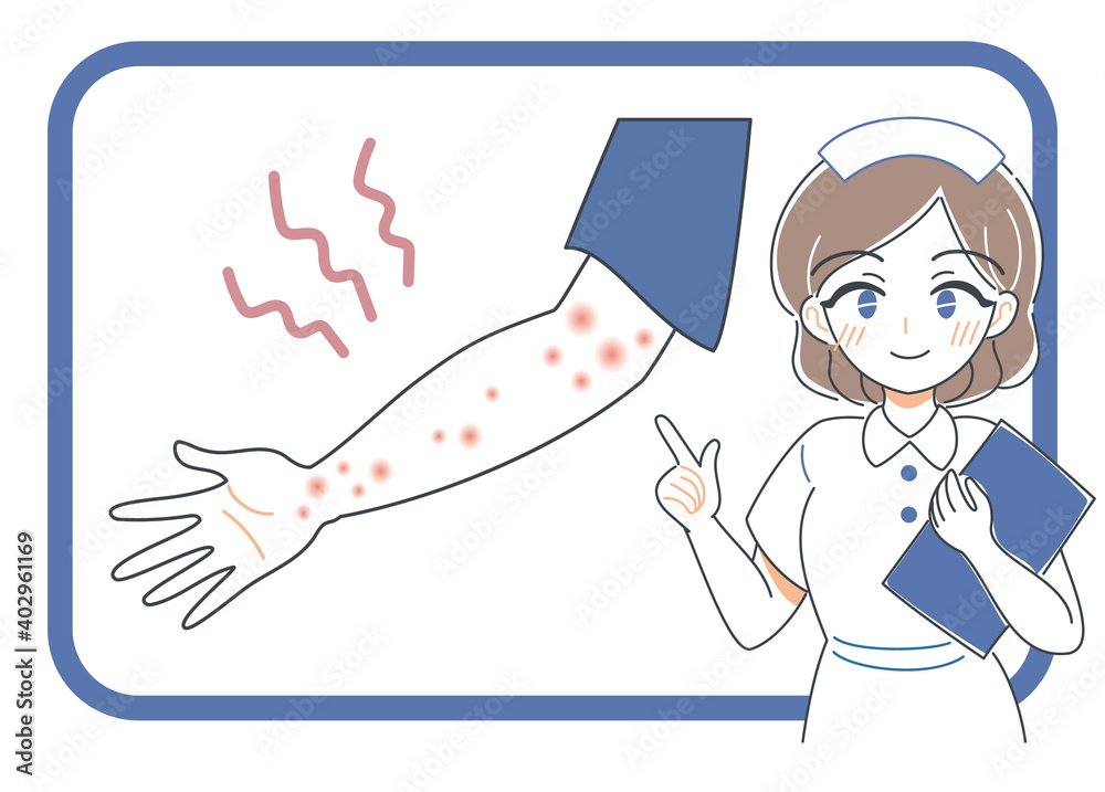 虫刺され 肌の炎症について説明する看護師のイラスト Stock Vector Adobe Stock