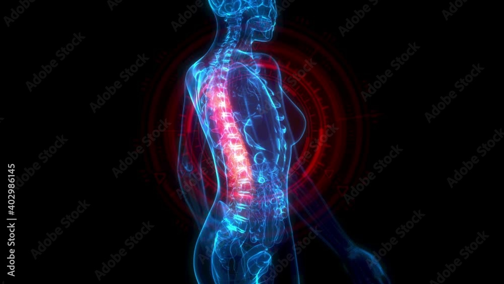 Thoracic, middle part of human spine on x-ray body - human body