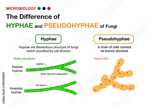Biology diagram show difference of true hyphae (hypha) in fungi mold with pseudohyphae in yeast