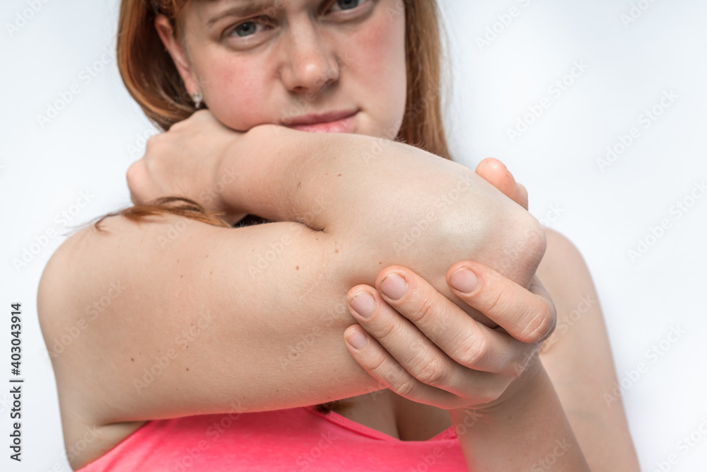 Woman with elbow pain is holding her aching arm Woman with elbow pain is holding her aching arm