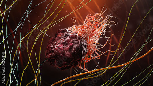 Cancer or tumor cell within fibrous tissue close-up 3D rendering illustration. Carcinoma, lymphoma, oncology, medicine, science, microbiology, cancerous pathology, health concepts. photo