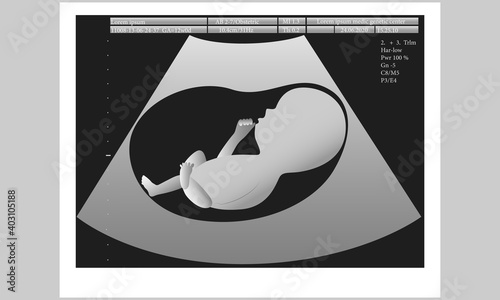 Ultrasound of unborn baby in mothers womb. Vector illustration.