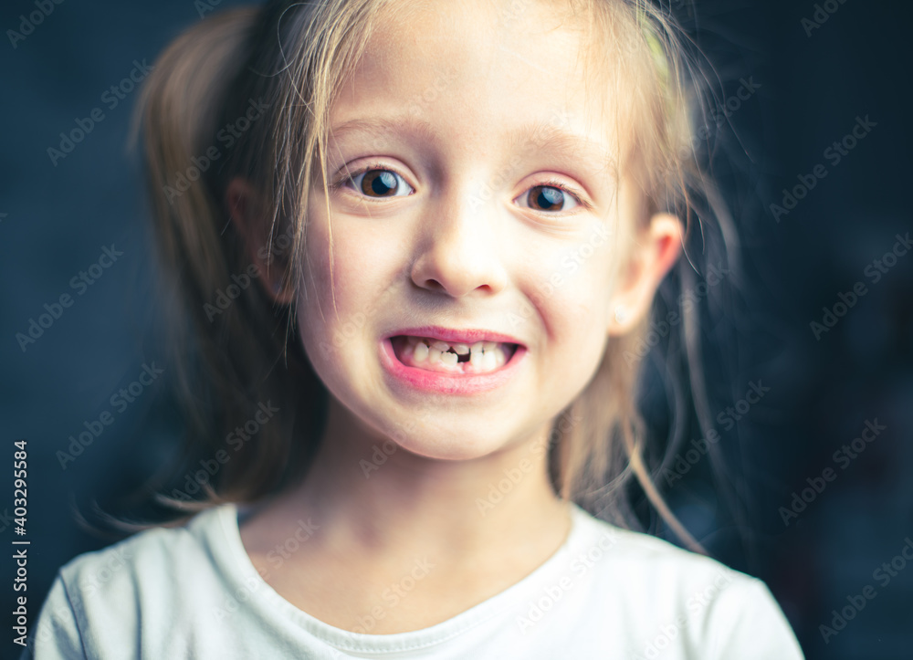 image of a little beautiful girl who lost a tooth image of a little beautiful girl who lost a tooth