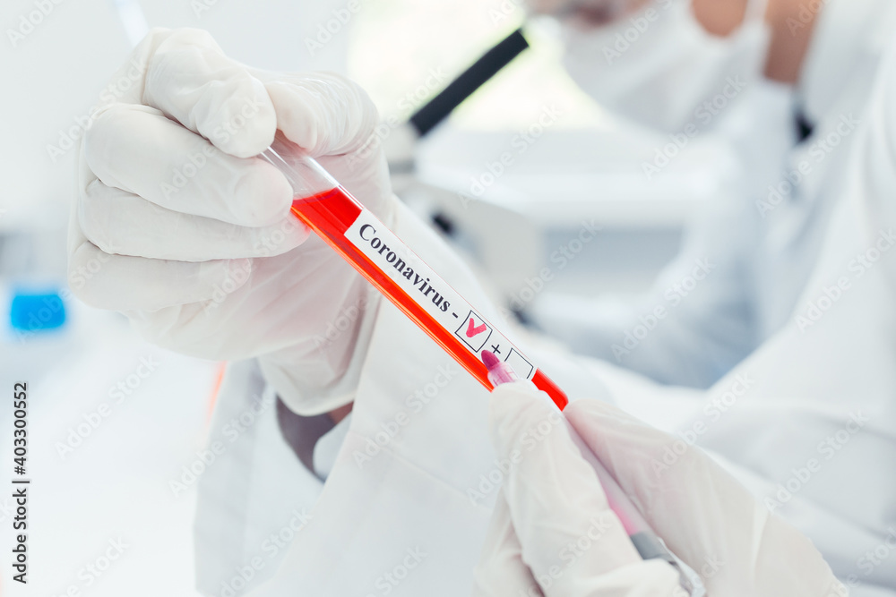 close up. tube with a test for coronavirus in the hands of a medic. close up. tube with a test for coronavirus in the hands of a medic.