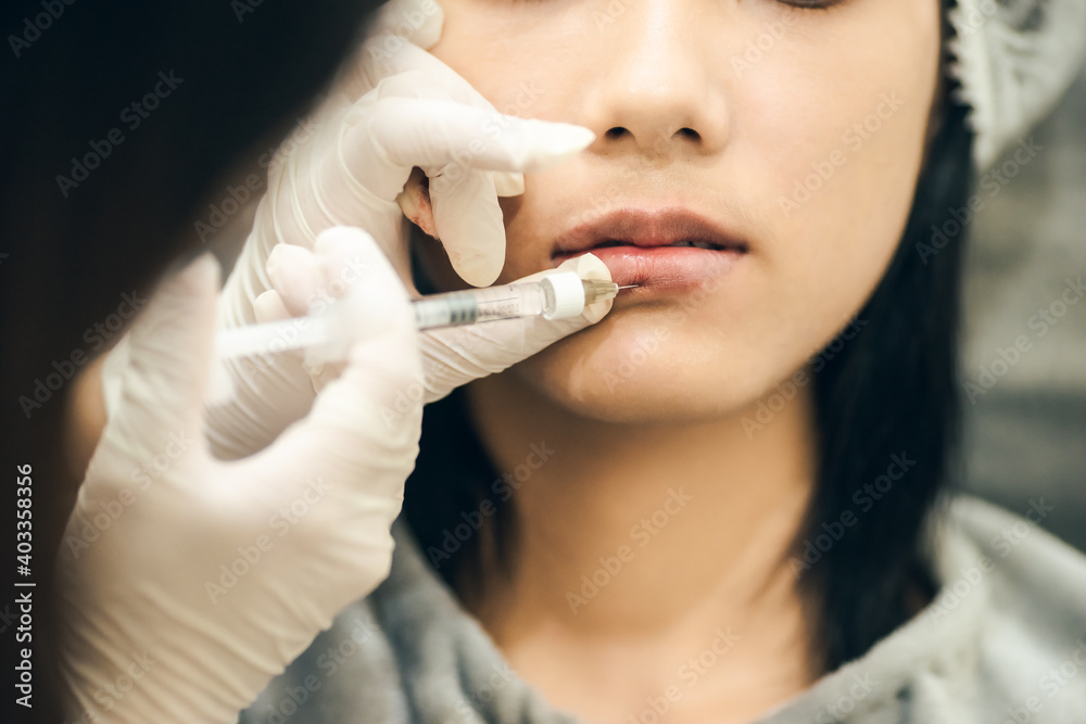 Closeup mouth of woman with filler syringe injection to her lip. cosmetologist  injection filler to mouth. Procedure lip augmentation. Add noise film grain.