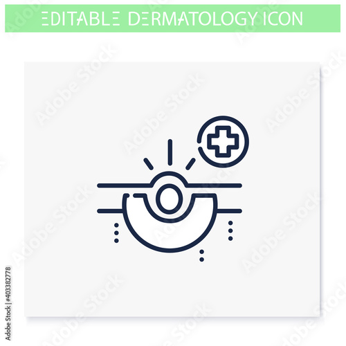 Acne line icon. Skin problem, dermatologic disease. Comedone, inflamed pimple. Skincare, cosmetology, medicine. Health and beauty concept. Isolated vector illustration. Editable stroke 