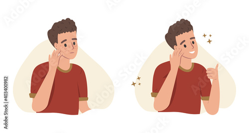 Young man or boy with two different skin conditions: acne, pimples, blackheads and healthy skin. Skincare, dermatology checkup. Face mask, cream. Teenager skin. Flat cartoon vector illustration.