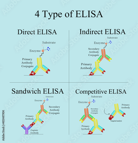 4 type of ELISA in laboratory, Direct, Indirect, Sandwich and Competitive ELISA. Biotechnology immunoassay