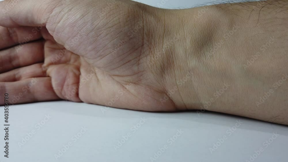 Close-up of man's wrist showing pulsating veins in multiple spots. Close-up of man's wrist showing pulsating veins in multiple spots.